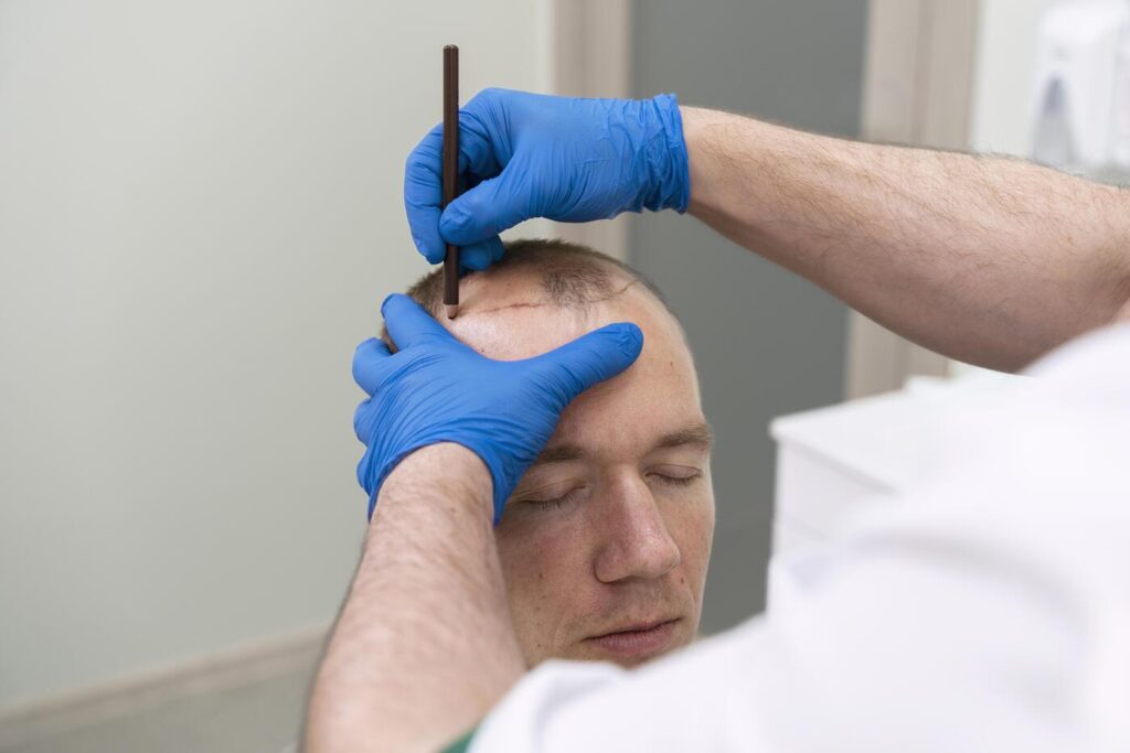 Hair transplant pain