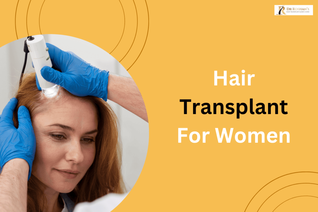 Hair Transplant for women in Bangalore