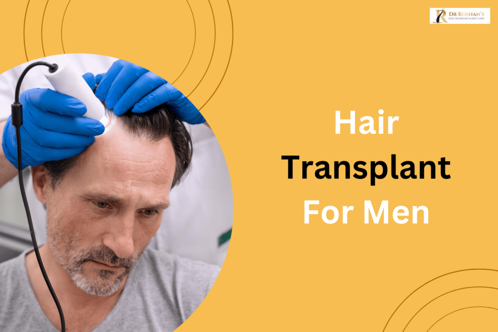 Hair Transplant for men in Bangalore