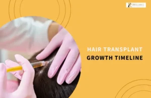 Hair Transplant Growth Timeline