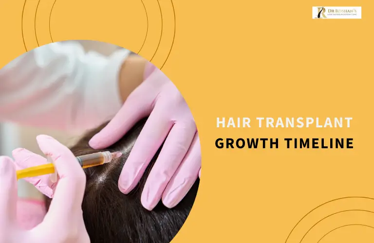 Hair Transplant Growth Timeline