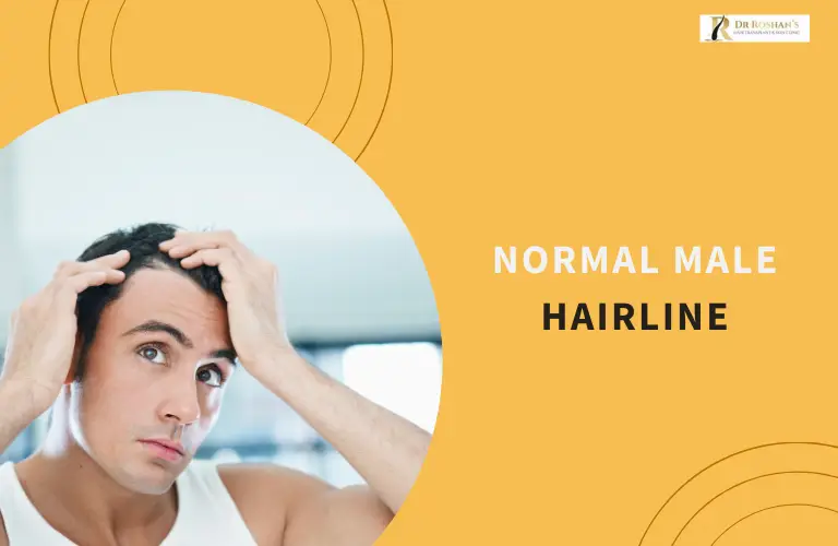 Normal Male Hairline