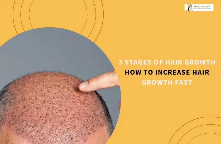 3 Stages of Hair Growth How to Increase Hair Growth Fast