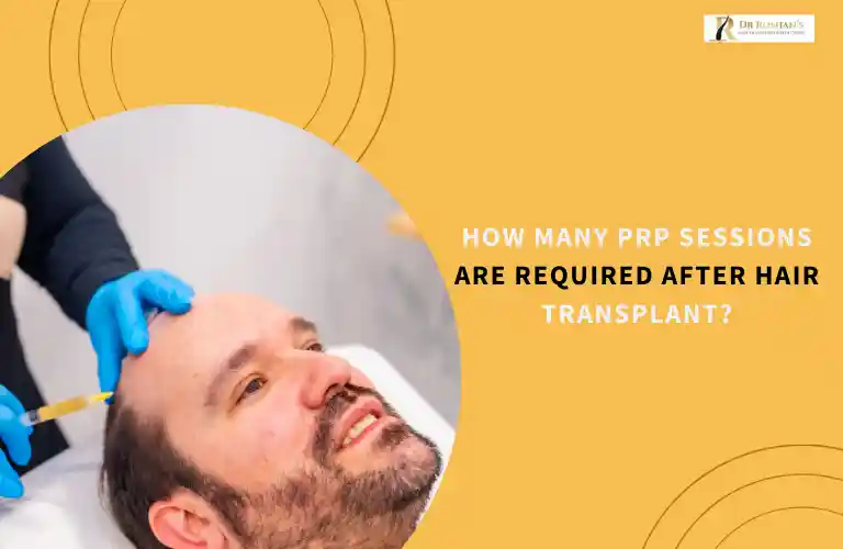 How Many PRP Sessions Are Required After Hair Transplant