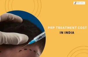 PRP Treatment Cost in India