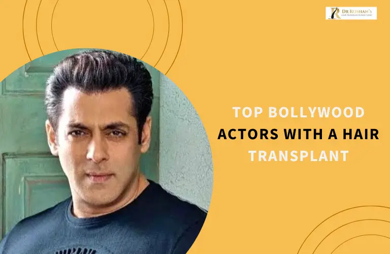 Top Bollywood Actors with a Hair Transplant