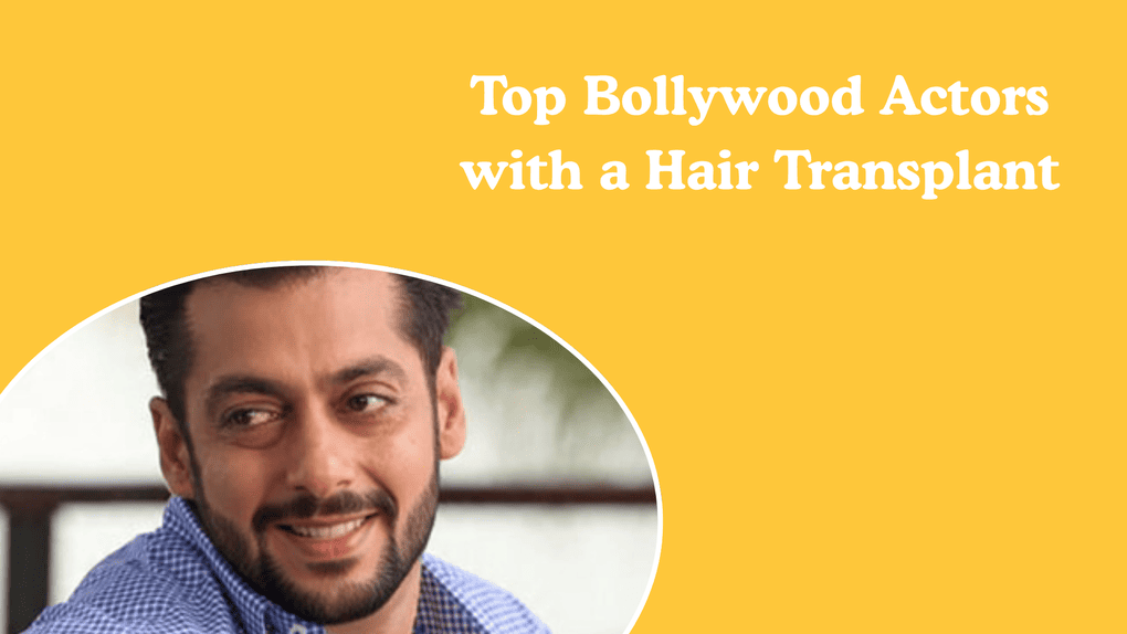 Top Bollywood Actors with a Hair Transplant