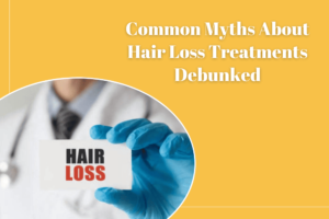 Common Myths About Hair Loss Treatments Debunked