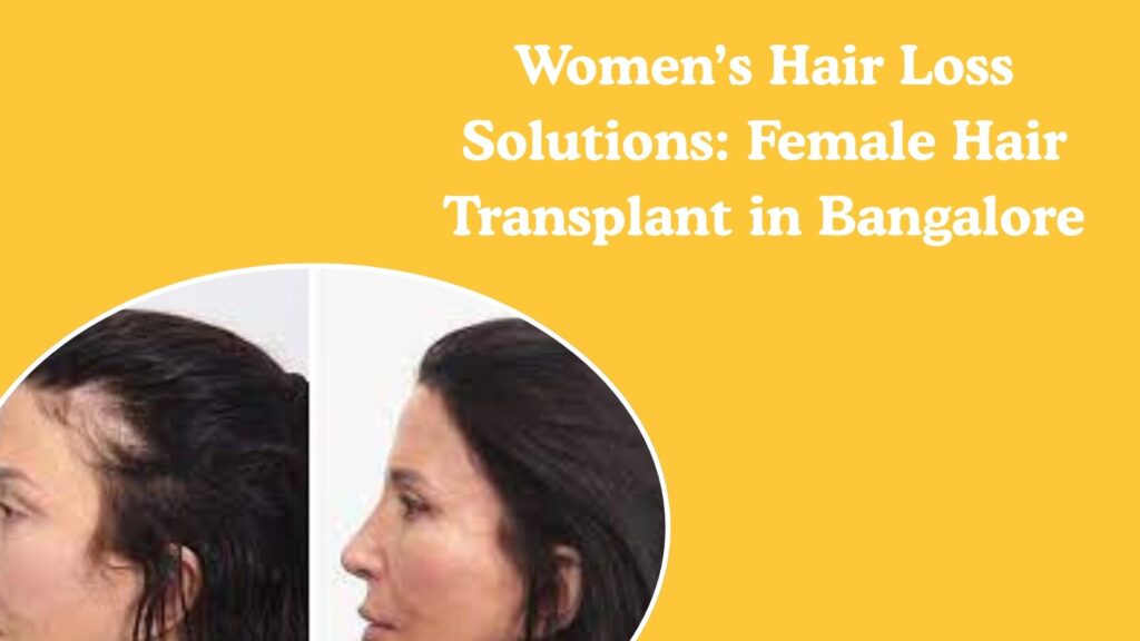 Women’s Hair Loss Solutions: Female Hair Transplant in Bangalore